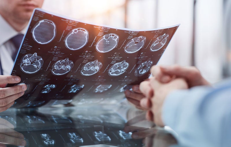 Brain injuries at work: What is the long-term damage?