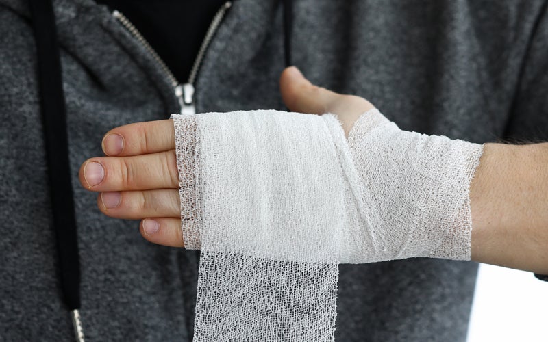 Three types of burn injuries workers should understand